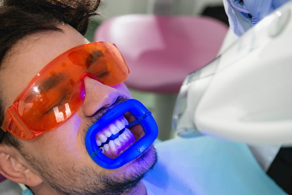 teeth-whitening-7dental-findlay-creek